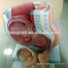 ISO Vivid Female Pelvis Model, Pelvis with Fetus Model